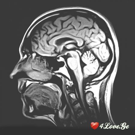 როგორ მოქმედებს სიყვარული ტვინზე?