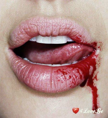 Dark side of Blood 9(მილანიტები)